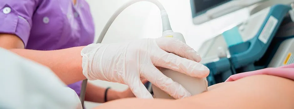 imagen hernia Epigástrica